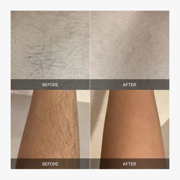 LumaSkin™ - Full-Body Smoothness, Zero Irritation