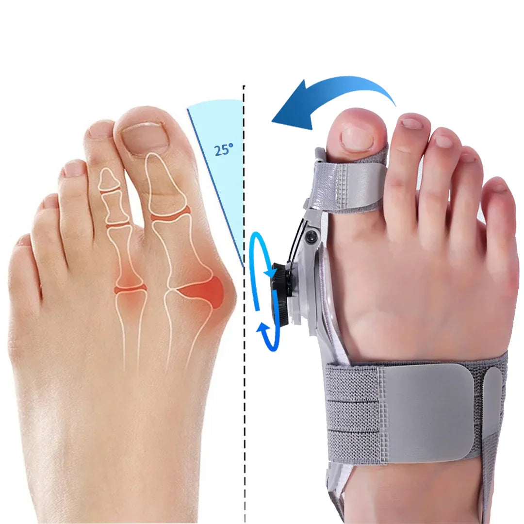 FootAlign - Bunion Corrector | Comfort en uitlijning voor gezonde voeten