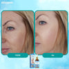 YouthGlow - Botox Anti-aging Serum