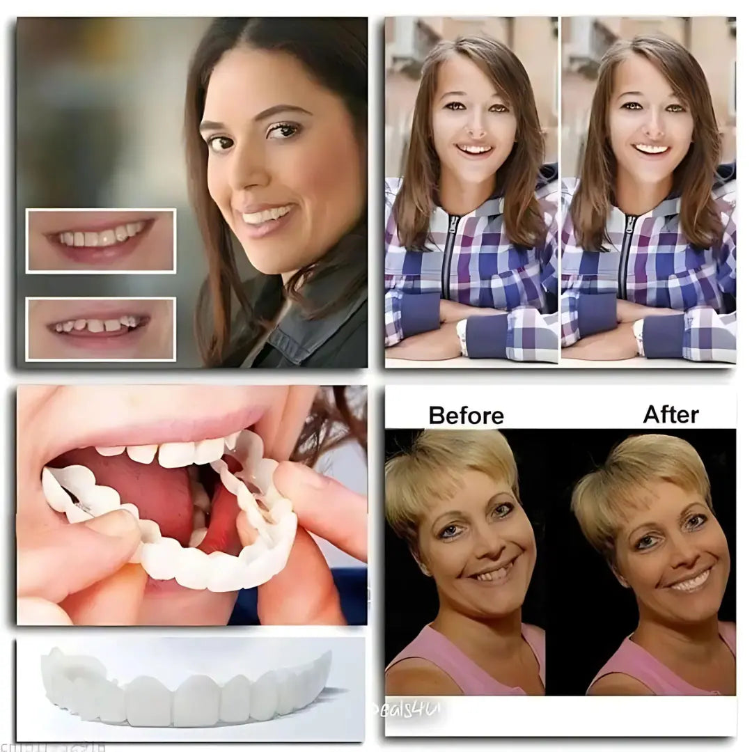 PerfectSmile Pro- Tijdelijke tanden Venner en prothese | 1+1 GRATIS