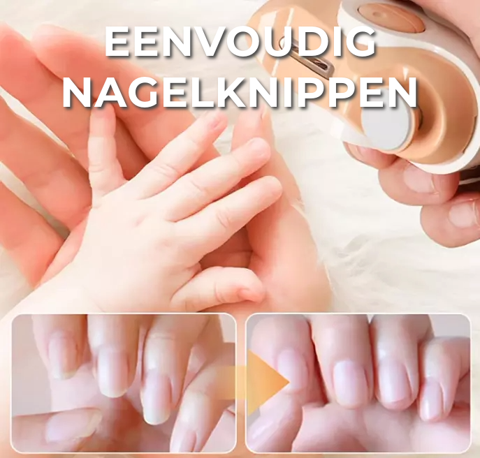 Trimlux- Automatic Nail Clipper  | 50% KORTING