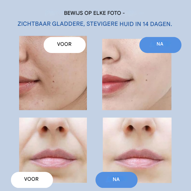 1+1 Gratis | LumièreLift™ Premium Skin Strips — Glad, Lifter en Revitaliseer onmiddellijk de natuurlijke uitstraling van uw huid
