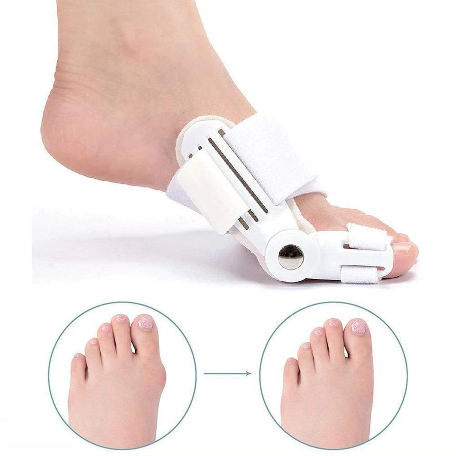 Corrigerende Spalk voor Hallux Valgus (1 Paar) - FootAlign