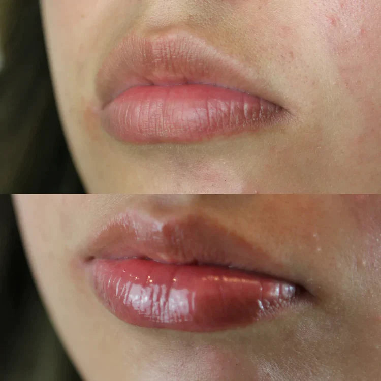 Lipbooster™ - Lipserum voor vollere lippen | 1+1 GRATIS!