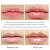 Lipbooster™ - Lipserum voor vollere lippen | 1+1 GRATIS!